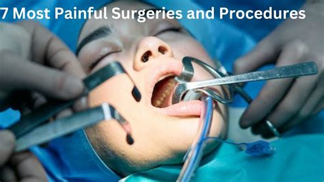 , skin biopsies), and dental work. . Top 25 most painful surgeries